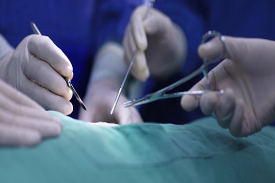 什么是协同作用