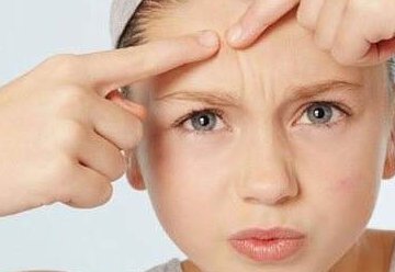 造成痘痘的13个原因都是什么？