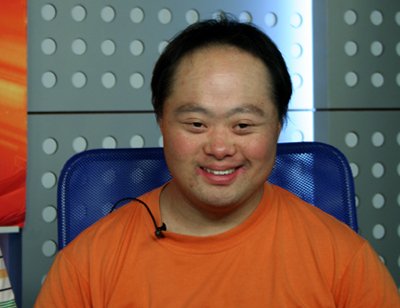 蒙古症的发病机制