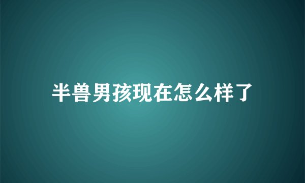 半兽男孩现在怎么样了