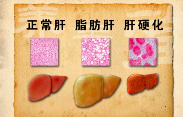 转归的三种情况分别是什么?