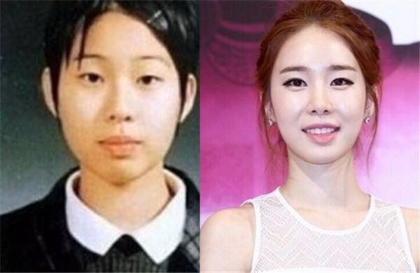 刘仁娜整容前后差别大 刘仁娜男友真是李光洙吗