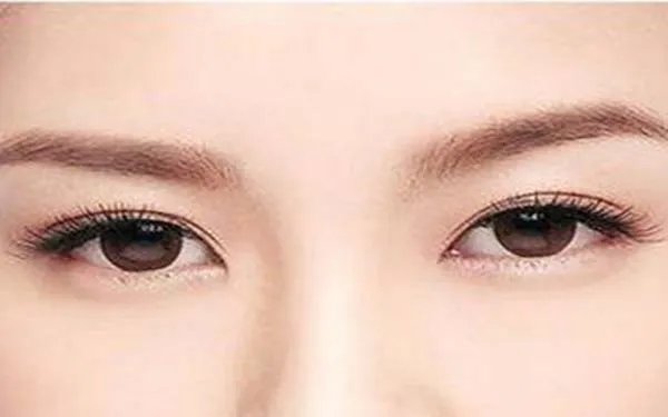 做开眼角手术大概需要多少钱