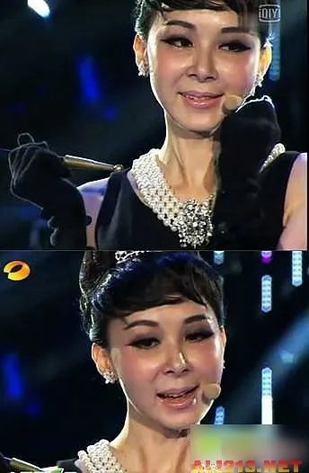 绝色美女整容过度 明星也难逃老残雷人宿命