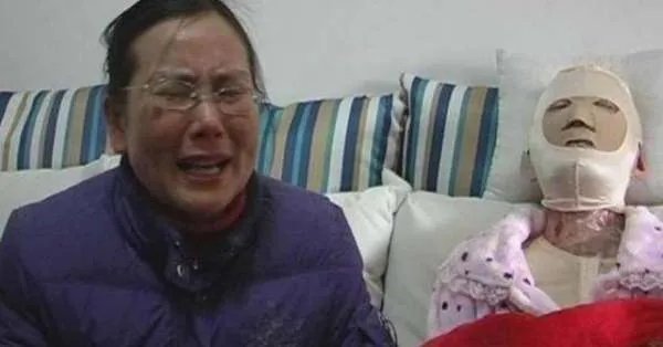 16岁少女曾因拒绝官二代追求，被其泼硫酸毁容，如今过得怎么样？