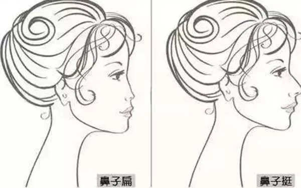 鼻部手术整形成都哪家医院好