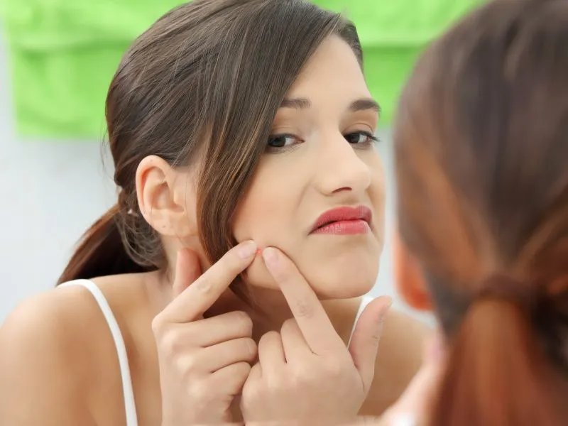 油性皮肤如何去痘痘