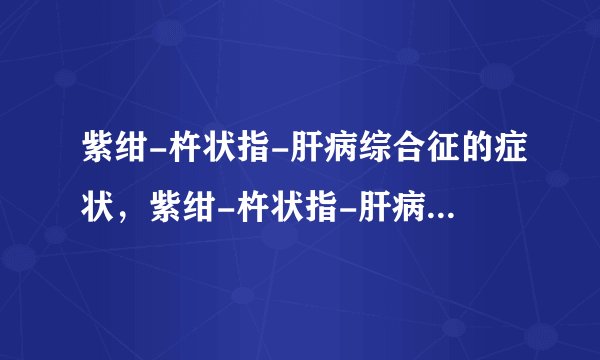 紫绀-杵状指-肝病综合征的症状，紫绀-杵状指-肝病综合征的早期症状，并发症
