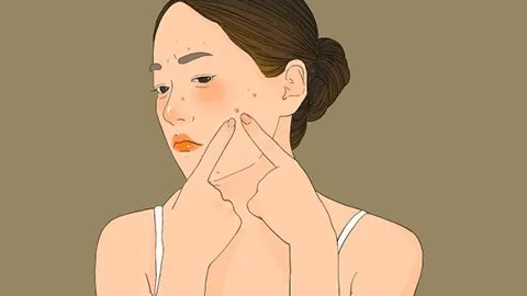 怎么治疗脸上的青春痘