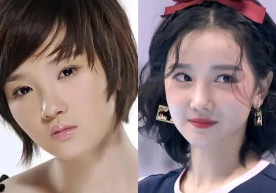 陈小纭前后对比，整骨前后对比图