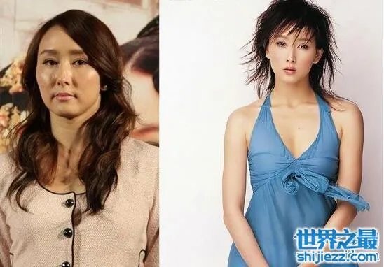 胡静整容前后照片，腮帮子都削没了/脸部僵硬的可怕 