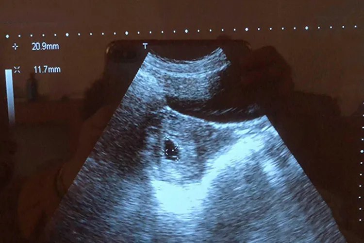 怀孕一个月小孩有多大图片