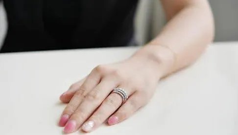 手背的老年斑怎样去除