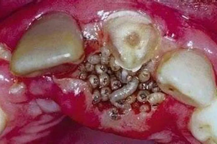 口腔蝇蛆病图片