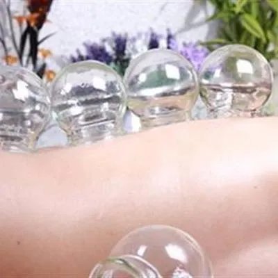 拔罐扎针减肥管用吗