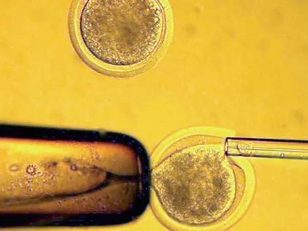 				陕西妇幼保健院三代试管婴儿助孕详细流程是怎么样的？			