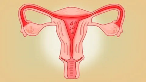 妇科炎症吃什么中药好