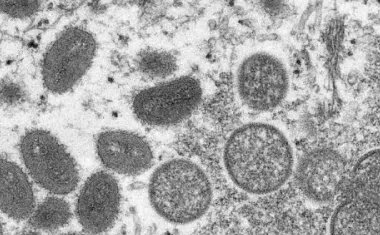 猴痘病毒疫情目前在其他国家的传播形式如何?