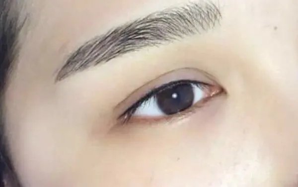 成都去眼袋口碑好的医院是哪家