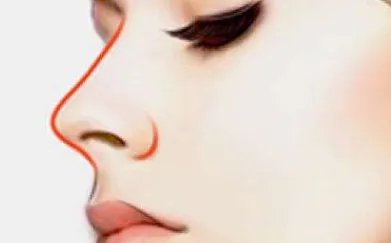 垫鼻子要多少钱