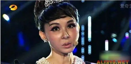 绝色美女整容过度 明星也难逃老残雷人宿命