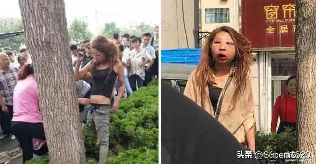 山东小三当街被打成猪头，据说当时已经神志不清了，现在好了吗？