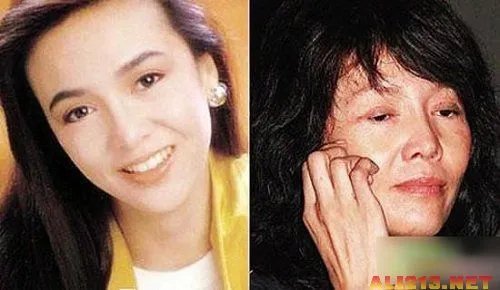 绝色美女整容过度 明星也难逃老残雷人宿命