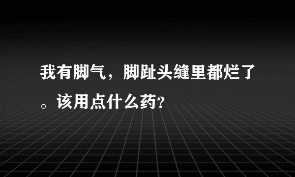 我有脚气，脚趾头缝里都烂了。该用点什么药？
