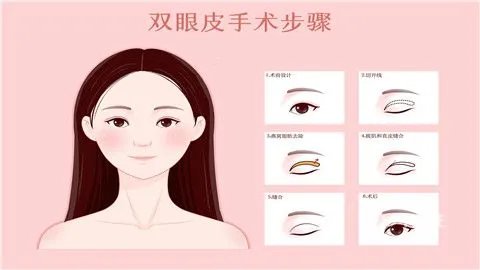 割双眼皮的坏处