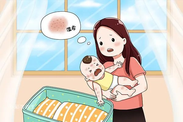 婴儿湿疹症状图片 婴儿湿疹的症状表现