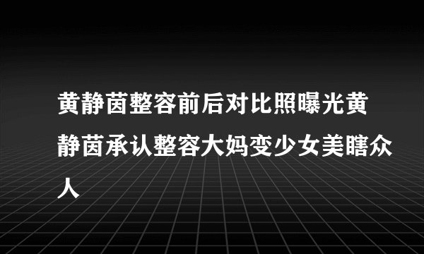 黄静茵整容前后对比照曝光黄静茵承认整容大妈变少女美瞎众人