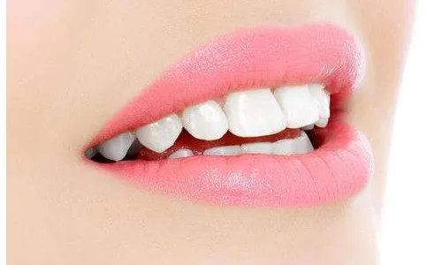 假牙种植的价钱