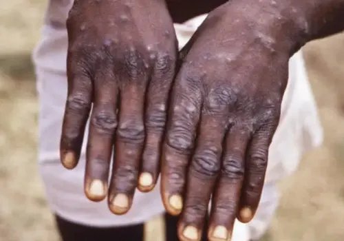 美国纽约州进入“灾难紧急状态”，这意味着什么？