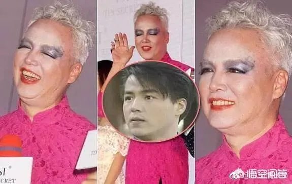 林瑞阳为什么满头白发 张庭老公像老奶奶