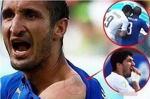 世界杯禁止咬人:奇葩规则是认真的吗(图)