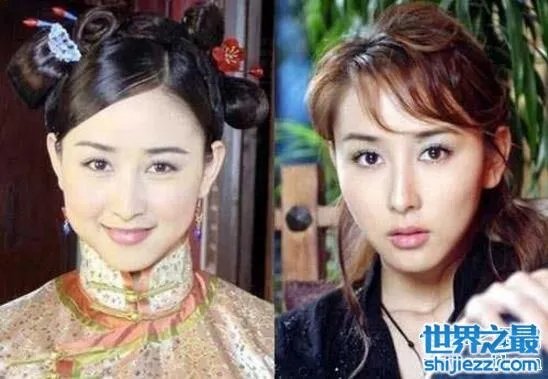 胡静整容前后照片，腮帮子都削没了/脸部僵硬的可怕 