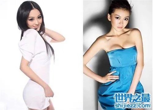 巩新亮整容前后差异大 网友直呼惨不忍睹 