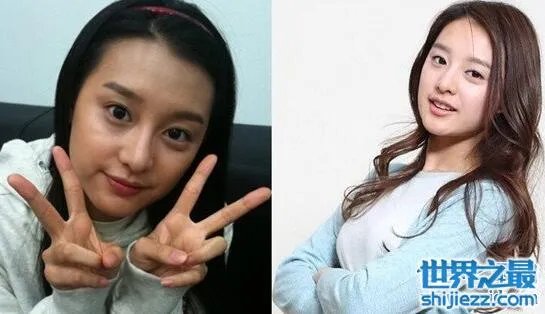 金智媛整容前后照片对比,皮肤黝黑四眼仔巨大眼袋