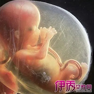 欣赏怀孕四个多月胎儿图片