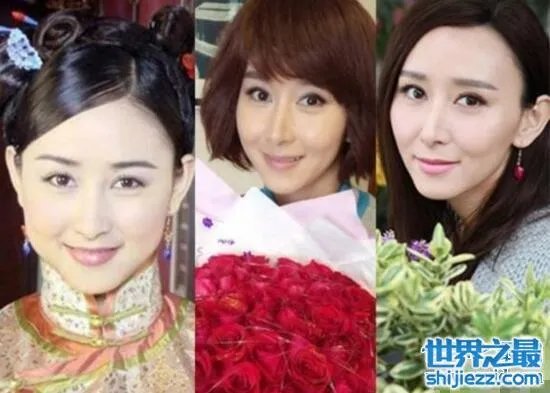 胡静整容前后照片，腮帮子都削没了/脸部僵硬的可怕 