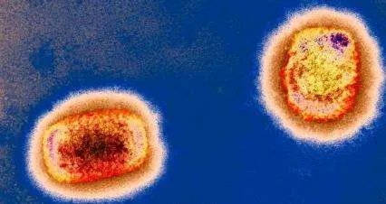 猴痘病毒疫情目前在其他国家的传播形式如何?