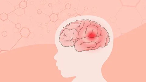 脑出血偏瘫能恢复吗