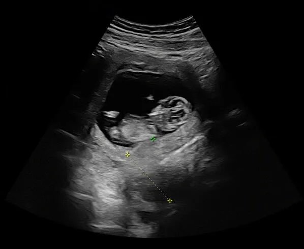 杨祐宁当爸是怎么回事 杨祐宁晒和未婚妻合照并宣布当爸