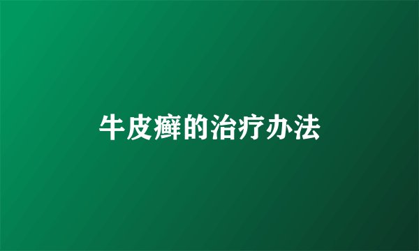 牛皮癣的治疗办法