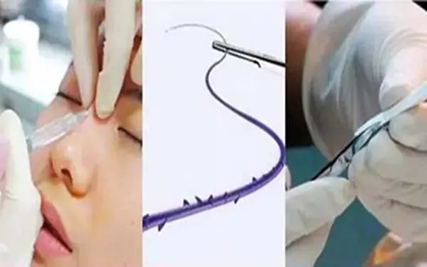 鼻部手术整形成都哪家医院好