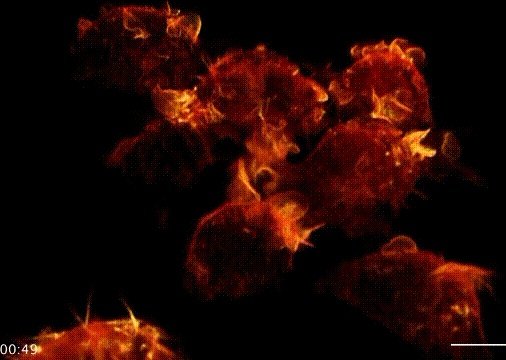 意大利3月19日单日新增病例4207例，为什么中国专家去了感觉没多少好转？