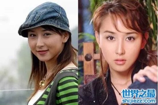 胡静整容前后照片，腮帮子都削没了/脸部僵硬的可怕 