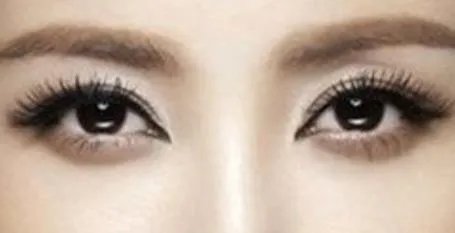 女生割双眼皮的危害