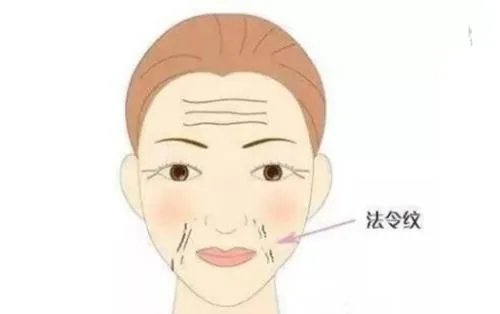 法令纹整形价格