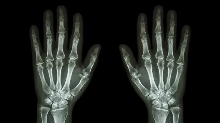 治疗风湿的药物都有哪些